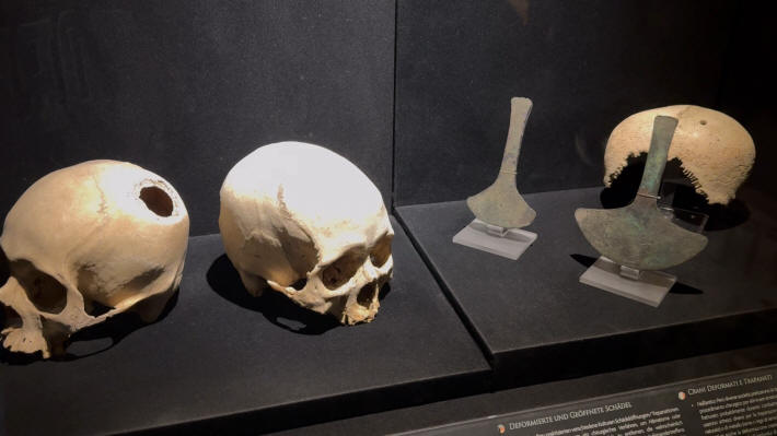 Lima Museo Largo